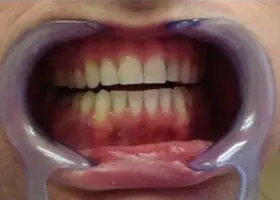 Dentist Alexandria VA Case Study 17 Before