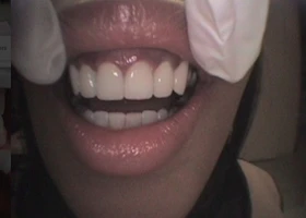 Dentist Alexandria VA Case Study 18 Before Portrait