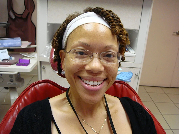 Case Study 20 - Complete Smile Transformation