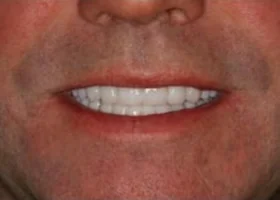 Dentist Alexandria VA Case Study 34 Before