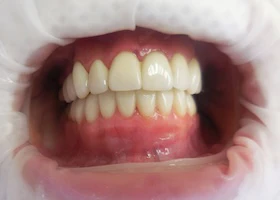 Dentist Alexandria VA Case Study 47 Before Portrait