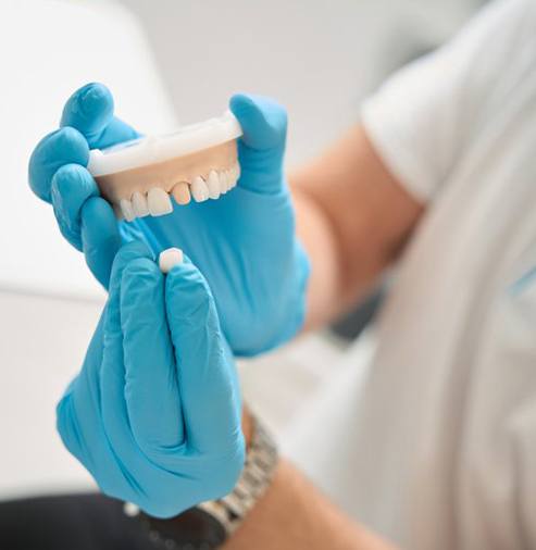 a dentist holding a model of teeth and a dental crown