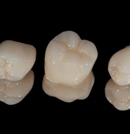 Three dental crowns