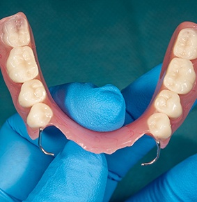 Blue-gloved hand holding a partial arch of dentures